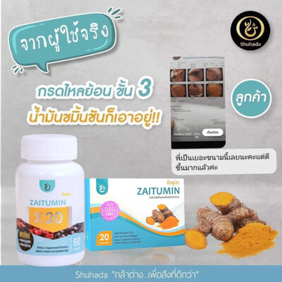 สารเคอคิวมิน,กรดไหลย้อน, ท้องอืด, ปวดท้อง, อาหารไม่ย่อย, curcumin, น้ำมันขมิ้น, ต้านอักเสบ, สารเคอร์คิวมิน, zaitumin, ซัยตูมิน